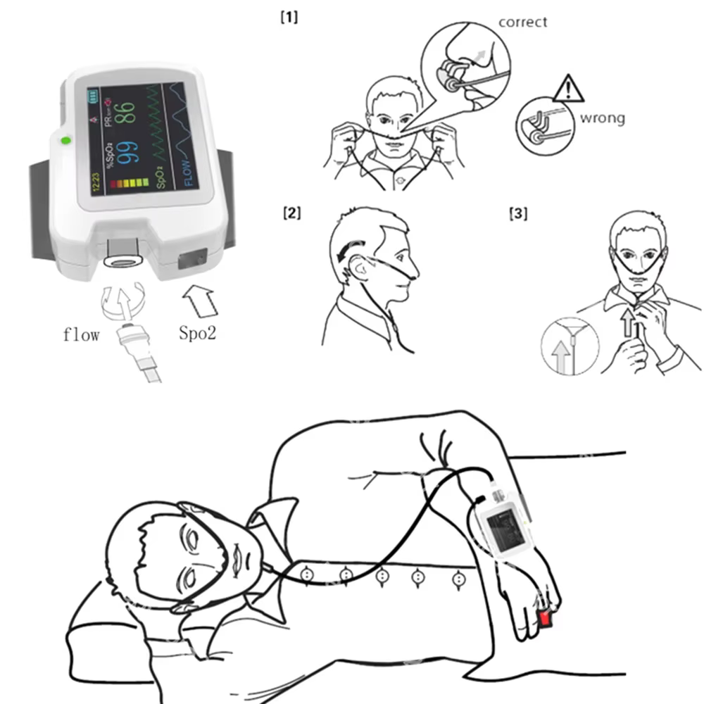 Fissurec RS01-Wrist-watch-Sleep-apnea-screen-meter-Respiration-Sleep-Monitor-PC-SW-CE