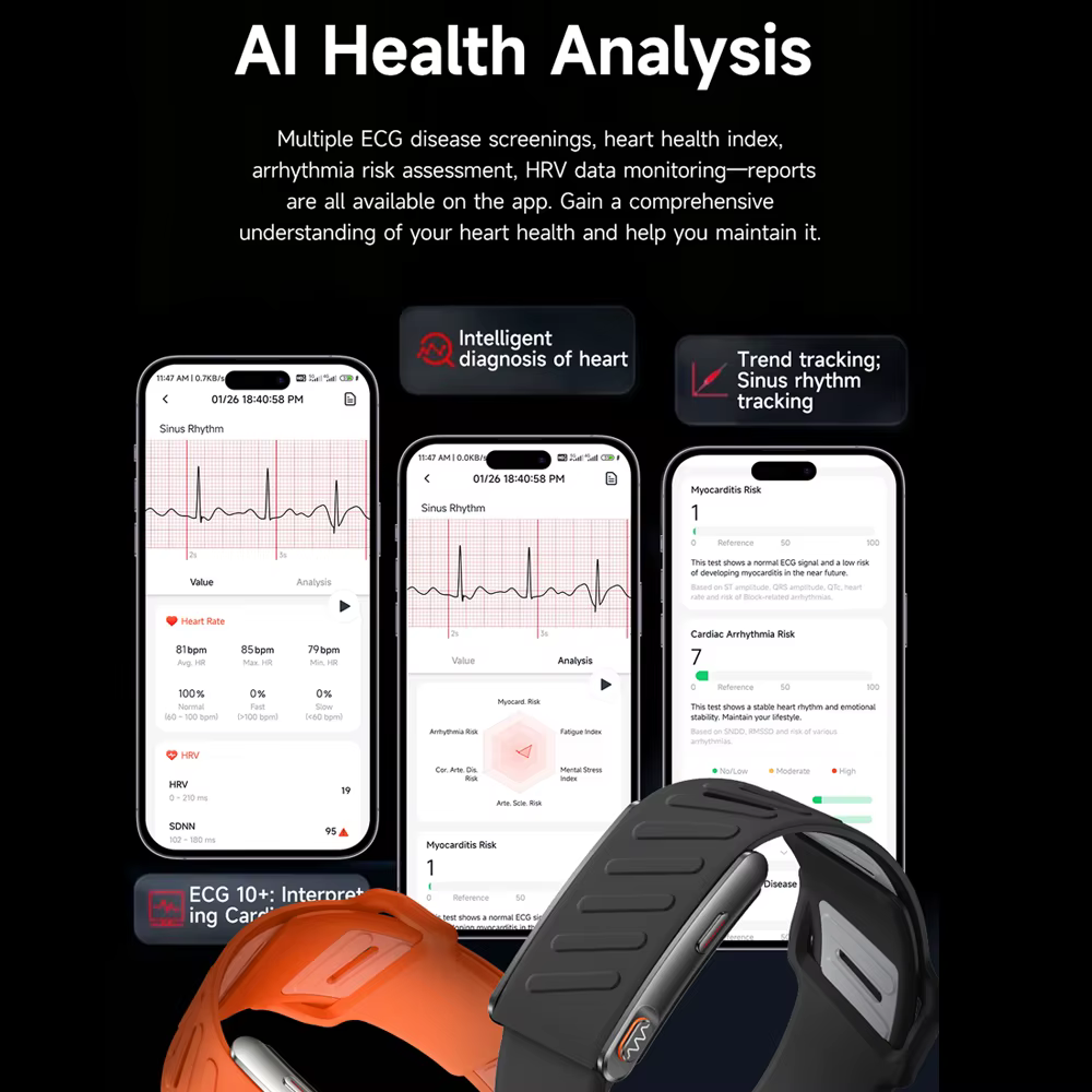 Nouvelle Montre Connectée ECG 2026 pour la Santé : Suivi Cardiaque