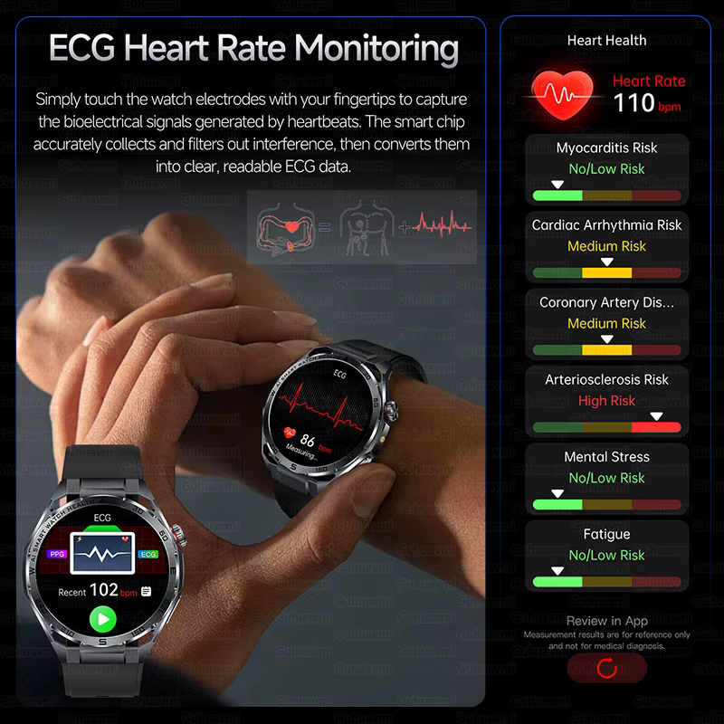 Nouvelle Montre Connectée ECG 2026 pour Hommes – Moniteur de Santé
